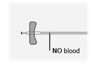 Siringa con ago sottile inserito, senza ritorno di sangue indicato da