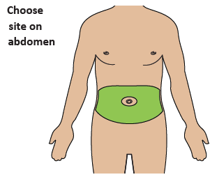 Torso umano stilizzato con evidenziata in verde l