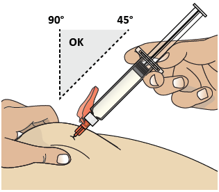 Siringa con ago che inietta farmaco nella pelle, angolazioni di 90&deg; e 45&deg; indicate, con freccia che mostra l