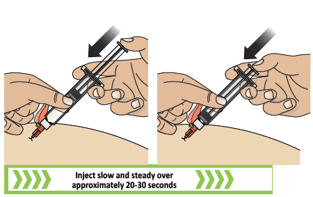 Mano che inietta farmaco sottocute con siringa, ago inserito nella pelle, frecce nere indicano direzione e velocit&agrave; di iniezione lenta e costante