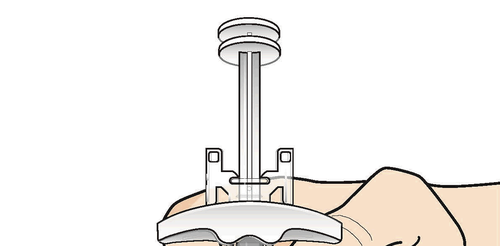 Dispositivo medico con base bianca e stelo centrale inserito in una pelle color pesca