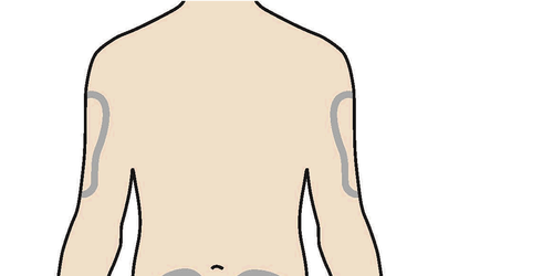 Schizzo della schiena umana con aree ombreggiate che indicano i possibili siti di iniezione intramuscolare sui glutei
