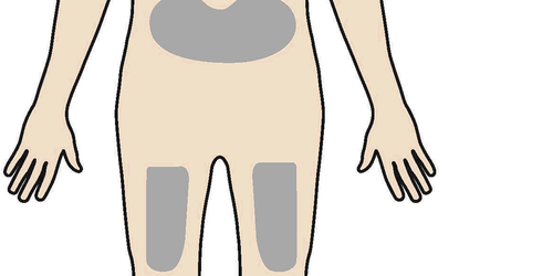 Corpo umano stilizzato con aree grigie che indicano possibili siti di iniezione sulle cosce e sull