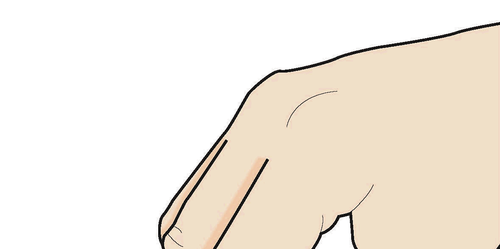 Braccio beige con due linee rosse parallele che indicano il sito di iniezione sottocutanea