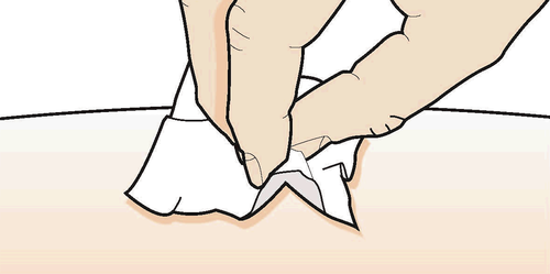 Mano che pizzica la pelle con due dita formando una piega, su sfondo color pesca chiaro