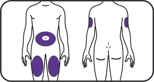 Schema corporeo con aree evidenziate in viola per iniezione sottocutanea addominale e glutei