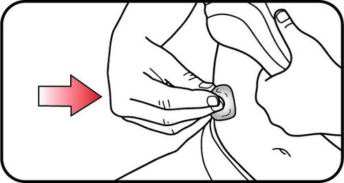 Mano che pizzica la pelle con due dita formando una piega, freccia rossa indica il punto di iniezione e ago parzialmente inserito