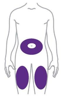 Schema del corpo umano con evidenziate in viola le aree di iniezione addominale e glutea