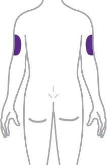 Schema del corpo umano con evidenziate in viola le aree dei muscoli deltoidi sulle spalle