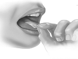 Mano che posiziona una compressa sublinguale sotto la lingua aperta con le dita che la guidano