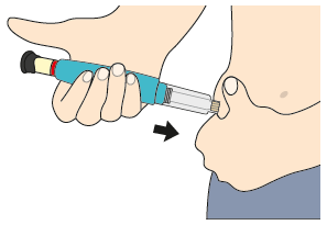 Mano che tiene un dispositivo per iniezione sottocutanea con ago che penetra nella piega della pelle addominale freccia indica la direzione
