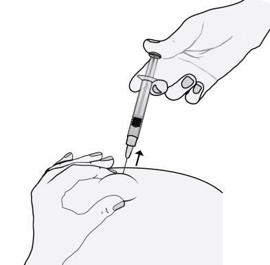 Mano che inserisce una siringa con ago in un braccio, freccia indica la direzione dell