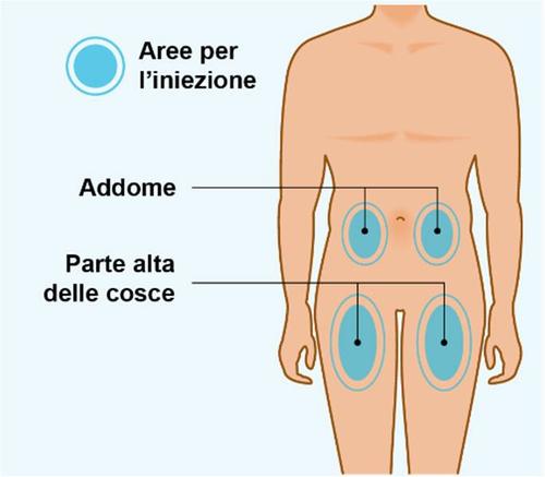 Schema del corpo umano con aree di iniezione evidenziate in blu sull