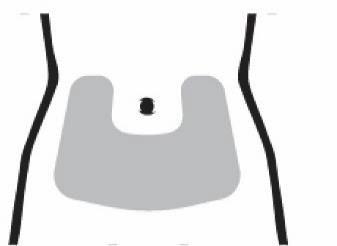 Schema stilizzato di addome con ombelico centrale e contorni laterali marcati in nero