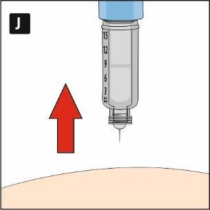 Siringa trasparente con scala graduata da 6 a 15 unit&agrave;, ago inserito nella pelle e freccia rossa che indica la direzione