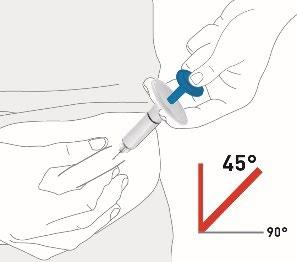 Mano che tiene una siringa con ago inserito nella pelle ad angolo di 45 gradi indicazione angolare con linea rossa e valori 45° e 90°
