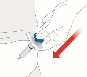 Mano che tiene un dispositivo autoiniettante con ago rivolto verso il basso e freccia rossa che indica la direzione di iniezione