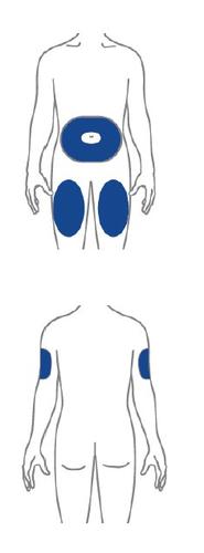 Schema del corpo umano con aree evidenziate in blu per iniezioni sottocutanee addominali e superiori delle braccia