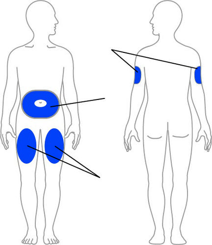 Schema corporeo con evidenziate in blu le aree di iniezione: glutei, cosce e braccia con frecce direzionali