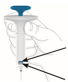 Mano che tiene un dispositivo autoiniettante bianco e blu con ago inserito e frecce nere che indicano il punto di iniezione