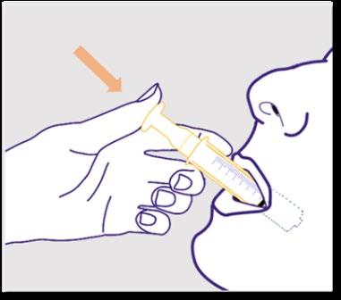 Mano che tiene una siringa orale con stantuffo giallo e punta inserita nella bocca aperta di un paziente con freccia arancione indicante la direzione