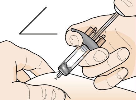 Mano che tiene una siringa preriempita con ago inserito nella pelle, inclinazione visibile e indicazione del punto di iniezione