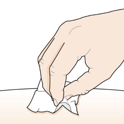 Mano che pizzica la pelle con due dita formando una piega, su sfondo cutaneo chiaro e uniforme