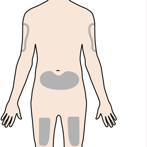 Schema del corpo umano con aree grigie che indicano possibili siti di iniezione nella parte superiore delle braccia e nella parte anteriore delle cosce
