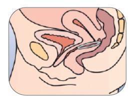Vista schematica dell