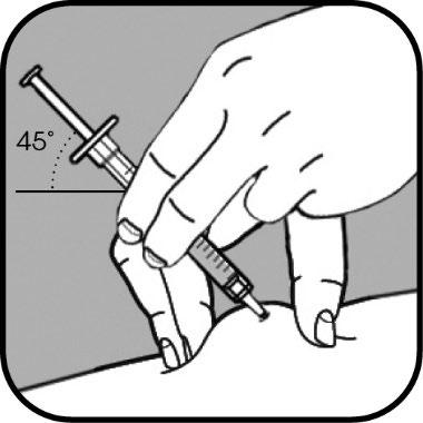 Mano che tiene una siringa inclinata a 45 gradi mentre inietta il farmaco nel braccio di un paziente con la pelle chiara