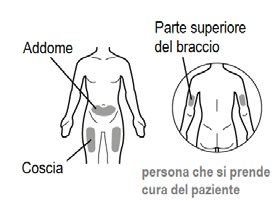 Schema del corpo umano con indicazioni di addome, coscia e parte superiore del braccio con zone evidenziate per iniezioni