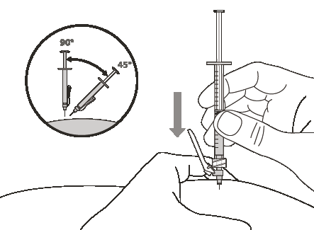 Mano che inserisce una siringa con ago nella pelle, freccia grigia indica la direzione, dettaglio ingrandito con angolazioni di 45 e 90 gradi