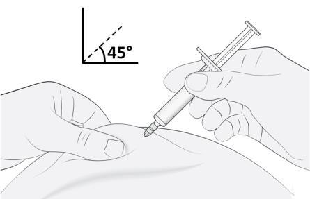 Mano che tiene una siringa inclinata di 45 gradi mentre inietta un farmaco nel braccio di un paziente