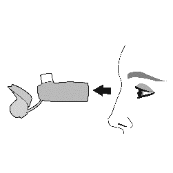 Dispositivo spray nasale con freccia che indica la direzione di inserimento nella narice e profilo del viso