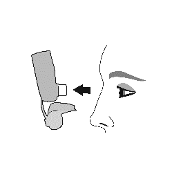 Profilo del viso con freccia nera che indica l