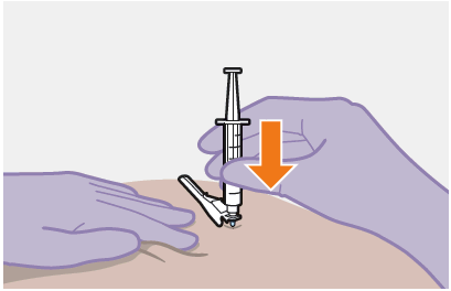 Mano con guanto viola che tiene una siringa con ago inserito nella pelle beige freccia arancione indica la direzione dell