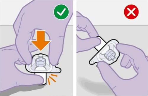 Mano che applica un dispositivo medico con freccia arancione e segno di spunta verde a sinistra e croce rossa a destra