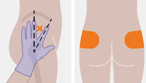 Mano con guanto viola che esegue un