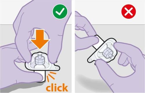 Mani con guanti viola che tengono un dispositivo medico, freccia arancione indica la pressione corretta con suono