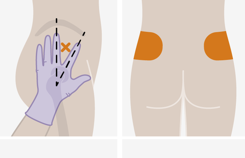 Mano guantata che esegue un