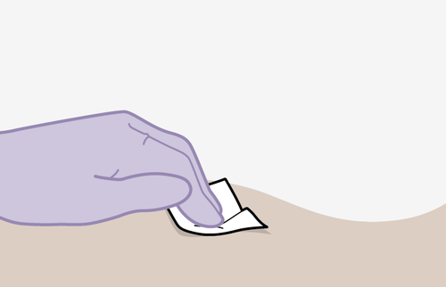 Mano con guanto viola che applica un tampone imbevuto sulla pelle beige chiara per la disinfezione prima di un