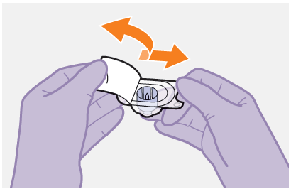 Mani con guanti viola che rimuovono un adesivo protettivo da un dispositivo medico circolare con una freccia arancione che indica la direzione