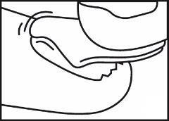 Pelle umana con piega cutanea e sottocute evidenziata da linee curve e tratteggiate