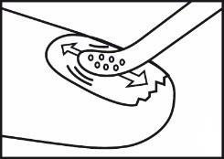 Cerotto adesivo con microaghi che penetrano nella pelle e freccia che indica la direzione di rimozione