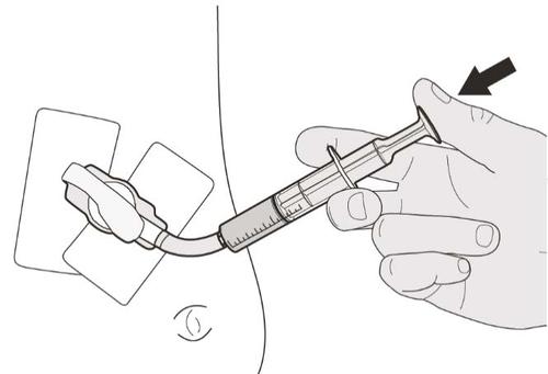 Mano che tiene una siringa pronta per l