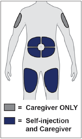 Schema del corpo umano con aree evidenziate per iniezioni, alcune grigie per somministrazione da parte di un caregiver e blu per auto-somministrazione