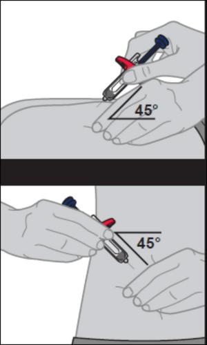 Mano che tiene una siringa con ago inserito nella pelle a 45 gradi, indicazione angolare con linea e numero, pelle chiara visibile