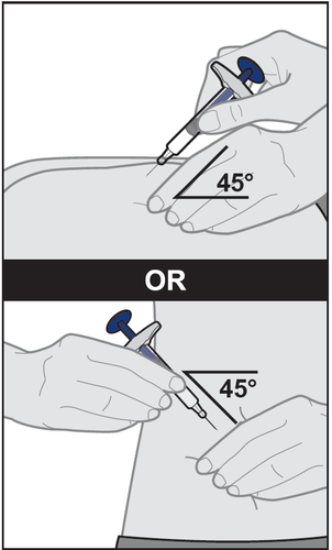 Mano che tiene una siringa inclinata a 45 gradi mentre inietta il farmaco nel braccio, con indicazione dell