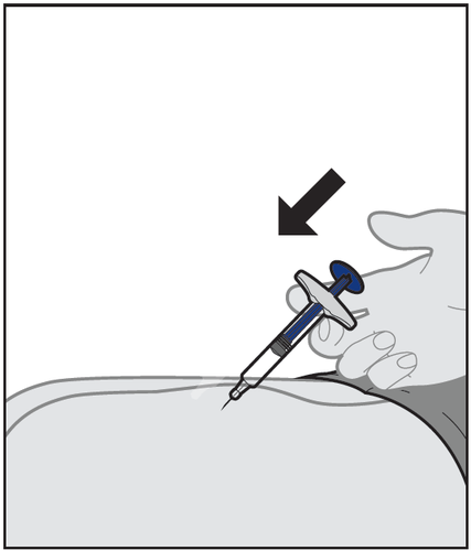 Siringa con ago inserito nella pelle, freccia nera indica la direzione dell