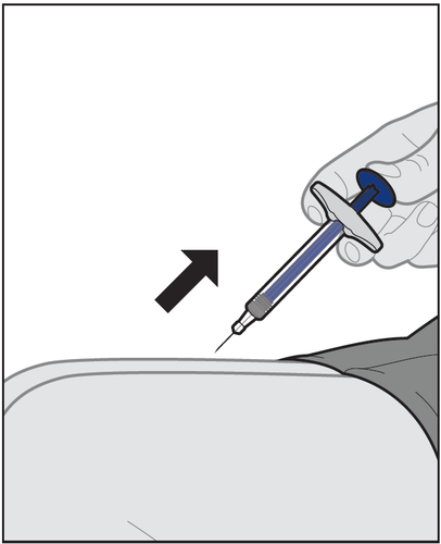 Mano che tiene una siringa blu con ago inserito nella pelle, freccia nera indica la direzione dell